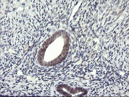 Immunohistochemical analysis of paraffin-embedded Human endometrium tissue labelling LZIC with ab140965 at 1/150 dilution.