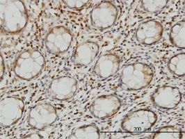 LZTFL1 antibody (ab57395) used in immunohistochemistry at 3ug/ml on formalin fixed and paraffin embedded human colon.