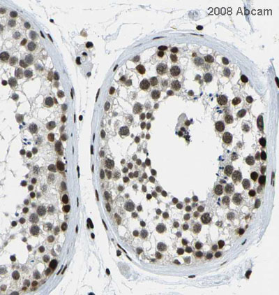 Image courtesy of Human Protein Atlas ab15584 staining histone H3 mono methyl R2 in human testis, showing a distinct and strong nuclear staining pattern in ductus seminiferus and leydig cells. Paraffin embedded human skin tissue was incubated with ab15584 (1/80 dilution) for 30 mins at room temperature. Antigen retrieval was performed by heat induction in citrate buffer pH 6. ab15584 was tested in a tissue microarray (TMA) containing a wide range of normal and cancer tissues as well as a cell microarray consisting of a range of commonly used, well characterised human cell lines. Further results for this antibody can be found at www.proteinatlas.org.