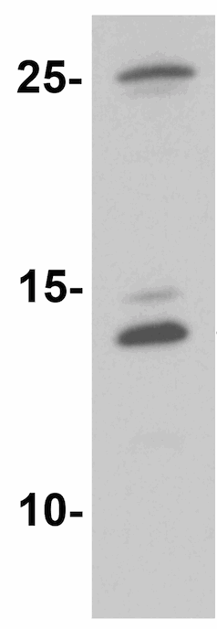 Anti-Macrophage Inflammatory Protein 1 beta antibody (ab167045) at 1 µg/ml + Rat brain lysate at 15 µg