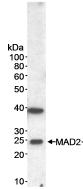 Anti-MAD2 antibody (ab70383) at 1 µg/ml + NETN whole cell lysate from HeLa cells at 50 µgdeveloped using the ECL technique