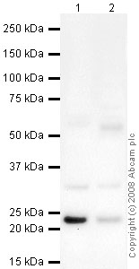 All lanes : Anti-MAD2 antibody (ab61591) at 1 µg/mlLane 1 : HeLa (Human epithelial carcinoma cell line) Whole Cell LysateLane 2 : HepG2 (Human hepatocellular liver carcinoma cell line) Whole Cell LysateLysates/proteins at 10 µg per lane.SecondaryGoat polyclonal to Rabbit IgG - H&L - Pre-Adsorbed (HRP) at 1/3000 dilutionPerformed under reducing conditions.