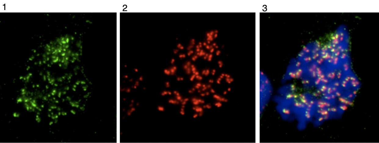 Immunofluorescence analysis of Mad2L1 in Human osteosarcoma cell line U2OS, using ab97777 at 1/1000 dilution. 1: Mad2L1 2: ACA 3: merged with DAPI Cells were fixed with 4% PFA/PBS for 15min, RT and blocked with 2.5% BSA/PBS.