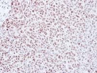 Immunohistochemical analysis of Mad2L1 in paraffin embedded DLD-1 xenograft, using ab97777 at a 1/500 dilution.