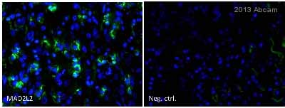 ab115622 staining Mad2L2 (green) in Human lung cancer cells by ICC/IF (Immunocytochemistry/immunofluorescence). Cells were fixed with the Hope technique. Samples were incubated with primary antibody (1/300) for 30 minutes at 25°C. An Alexa Fluor®488-conjugated Goat anti-rabbit IgG polyclonal (1/200) was used as the secondary antibody. Right - negative control.See Abreview