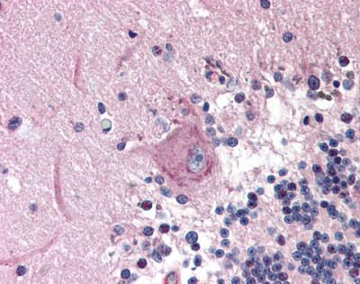 ab115622, at 10µg/ml, staining Mad2L2 in Formalin-fixed, Paraffin-embedded Human Brain Cerebellum tissue by Immunohistochemistry followed by biotinylated secondary antibody, alkaline phosphatase-streptavidin and chromogen.