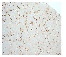 ab108525 at 1/100 dilution staining MAD3 in paraffin-embedded Human brain tissue by Immunohistochemistry (Formalin/PFA-fixed paraffin-embedded sections).