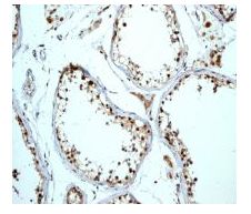 ab108525 at 1/100 dilution staining MAD3 in paraffin-embedded Human testis tissue by Immunohistochemistry (Formalin/PFA-fixed paraffin-embedded sections).
