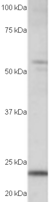 Anti-MAD4 antibody (ab15841) at 0.5 µg/ml + Lysates prepared from human kidney tissue at 35 µg