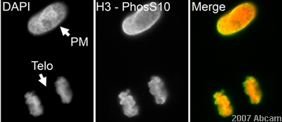 ab32107 (1/1000) staining Histone H3 (phospho S10) in paraformaldehyde-fixed, DAPI counterstained HeLa cells. Secondary antibody: Goat anti-Rabbit IgG conjugated to Cy3® (1/200). Please refer to abreview for further details.See Abreview
