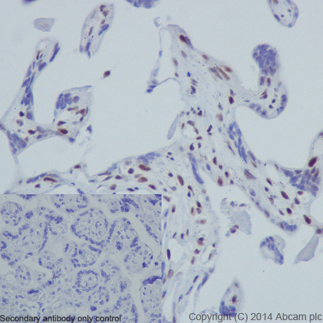 Immunohistochemical analysis of paraffin-embedded Human placenta tissue labeling Histone H3 (phospho S10) with ab177218 at 1/1000 dilution, followed by Goat Anti-Rabbit IgG H&L (HRP) (ab97051) secondary antibody at 1/500 dilution. Nucleus staining on Human placenta tissue is observed. Counter stained with Hematoxylin.Negative control: Used PBS instead of primary antibody, secondary antibody is Goat Anti-Rabbit IgG H&L (HRP) (ab97051) at 1/500 dilution.