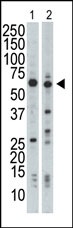 All lanes : Anti-MADM antibody - Aminoterminal end (ab37619) at 1/100 dilutionLane 1 : HL-60 cell lysateLane 2 : mouse brain tissue lysateSecondaryHRP-anti-rabbit visualised with chemiluminescence.