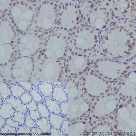 Immunohistochemical analysis of paraffin-embedded mouse colon tissue labeling Histone H3 (phospho S10) with ab177218 at 1/1000 dilution, followed by Goat Anti-Rabbit IgG H&L (HRP) (ab97051) secondary antibody at 1/500 dilution. Nucleus staining on mouse colon tissue is observed. Counter stained with Hematoxylin.Negative control: Used PBS instead of primary antibody, secondary antibody is Goat Anti-Rabbit IgG H&L (HRP) (ab97051) at 1/500 dilution.