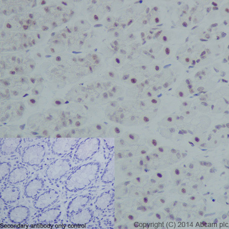 Immunohistochemical analysis of paraffin-embedded rat colon tissue labeling Histone H3 (phospho S10) with ab177218 at 1/1000 dilution, followed by Goat Anti-Rabbit IgG H&L (HRP) (ab97051) secondary antibody at 1/500 dilution. Nucleus staining on rat colon tissue is observed. Counter stained with Hematoxylin.Negative control: Used PBS instead of primary antibody, secondary antibody is Goat Anti-Rabbit IgG H&L (HRP) (ab97051) at 1/500 dilution.