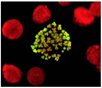 This image was kindly supplied by Prof Bryan Turner, University of Birmingham. Female Human Lymphoblastoid cells were incubated with ab5176. 
