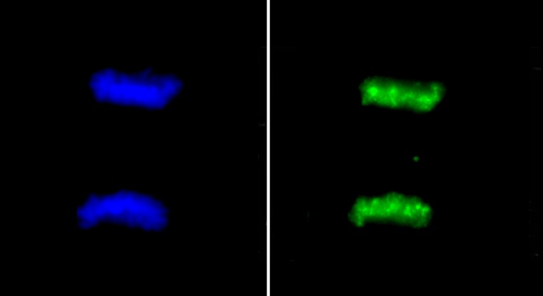 SKN cells stained with ab5176 (green) at a dilution of 1/100. The cells were fixed in paraformaldehyde for 10 minutes prior to incubation with ab5176. The DNA is stained with DAPI (blue). 100x magnification.