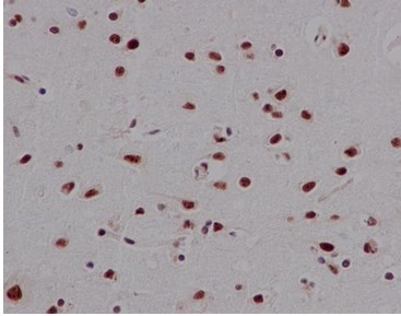 Immunohistochemical analysis of paraffin-embedded Human brain tissue labeling Mago nashi homolog 2 with ab186431 at 1/1000 dilution. Counter stain Hematoxylin.