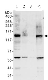 All lanes : Anti-MAML1 antibody (ab70486) at 0.04 µg/mlLane 1 : Whole cell lysate from HeLa cells at 50 µgLane 2 : Whole cell lysate from HeLa cells at 15 µgLane 3 : Whole cell lysate from HeLa cells at 5 µgLane 4 : Whole cell lysate from 293T cells at 50 µgdeveloped using the ECL technique