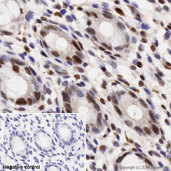 IHC image of ab32388 staining Histone H3 in Human normal colon formalin fixed paraffin embedded tissue* sections, performed on a Leica Bond. The section was pre-treated using heat mediated antigen retrieval with sodium citrate buffer (pH6, epitope retrieval solution 1) for 20 mins. The section was then incubated with ab32388, 0.1ug/ml, for 15 mins at room temperature and detected using an HRP conjugated compact polymer system. DAB was used as the chromogen. The section was then counterstained with haematoxylin and mounted with DPX. No primary antibody was used in the negative control (shown on the inset).For other IHC staining systems (automated and non-automated) customers should optimize variable parameters such as antigen retrieval conditions, primary antibody concentration and antibody incubation times.*Tissue obtained from the Human Research Tissue Bank, supported by the NIHR Cambridge Biomedical Research Centre