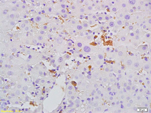 Immunohistochemical analysis of formalin-fixed, paraffin-embedded Rat liver tissue labeling Mannan Binding Lectin with ab203303 at 1/200 dilution followed by conjugation to the secondary antibody and DAB staining.