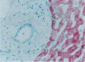 ab23457 at 1 mg/ml staining human liver by IHC-P