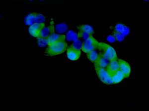 Immunofluorescence analysis of Mannan Binding Lectin in HepG2 cells, using ab133629 at a dilution of 1/10.