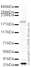 Anti-Mannose Receptor antibody (ab64693) at 1 µg/ml + Liver (Rat) Tissue Lysate at 10 µgSecondaryGoat polyclonal to Rabbit IgG - H&L - Pre-Adsorbed (HRP) at 1/3000 dilutionPerformed under reducing conditions.