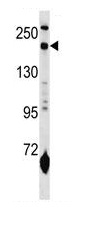Anti-Mannose Receptor antibody (ab129666) at 1/100 dilution + Mouse lung tissue lysate at 35 µg