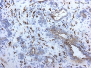 ab8918 staining Mannose Receptor in human mammary gland tissue section by Immunohistochemistry (Frozen sections). Tissue samples were fixed with 70% Ethanol and blocking for 10 minutes at RT was performed. The sample was incubated with primary antibody (1/10) for 1 hour. A HRP-conjugated mouse polyclonal to mouse IgG was used undiluted as secondary antibody.See Abreview