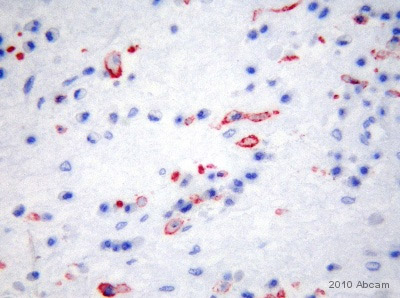 ab8918 staining the Mannose Receptor in Human nasal polyp and tonsil tissue sections by Immunohistochemistry (resin-embedded sections). The tissue was fixed in acetone and inhibitors and embedded into GMA resin. Samples were incubated with primary antibody (1/400 in Tris buffered saline) for 18 hours at 21°C. A Biotin-conjugated Rabbit anti-mouse polyclonal (1/1000) was used as the secondary antibody.See Abreview