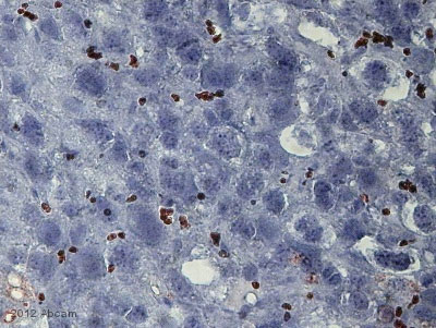 Immunohistochemical analysis of murine uterus tissue sections, staining Mannose Receptor with ab8918.Tissue was fixed with paraformaldehyde and blocked with 3% BSA for 30 minutes at room temperature. Samples were incubated with primary antibody (1/40 in 1% BSA) for 1.5 hours. An undiluted HRP-conjugated rabbit anti-mouse polyclonal IgG was used as the secondary antibody.See Abreview