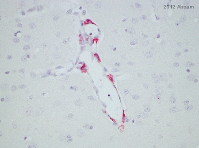 ab117644 staining Mannose Receptor in rhesus monkey brain tissue sections by Immunohistochemistry (IHC-P - paraformaldehyde-fixed, paraffin-embedded sections). Tissue was fixed with formaldehyde and blocked with 20% serum for 1 hour at 37°C; antigen retrieval was by heat mediation in a citrate buffer. Samples were incubated with primary antibody (1/200 in 10% serum in 20% Normal Horse Serum in 1X TTBS) for 12 hours at 37°C. A biotin-conjugated horse anti-mouse IgG polyclonal (1/200) was used as the secondary antibody.See Abreview