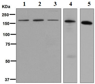 All lanes : Anti-Mannose Receptor antibody [EPR6828(B)] (ab125028) at 1/1000 dilutionLane 1 : BxPC3 lysateLane 2 : Caco2 lysateLane 3 : HepG2 lysateLane 4 : Human fetal liver lysateLane 5 : 293T lysateLysates/proteins at 10 µg per lane.SecondaryHRP labelled goat anti rabbit at 1/2000 dilution