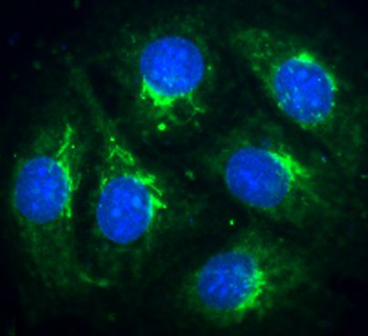 COS7 cells were fixed with cold methanol for 10 minutes followed by incubation with ab12277 (1/200) in 5% normal goat serum. FITC-conjugated goat anti-rabbit was used to visualise bound rabbit antibodies. Nuclei were stained with DAPI.