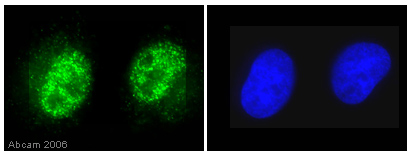 SKN-SH cells were fixed in 4% paraformaldehyde for 10 mins, permeabilized in PBS-0.5% Triton X-100 for 5 mins and incubated for 30 minutes with ab5168 (1/100). The slides were rinsed once in PBS-Triton (0.1%), twice in PBS then incubated with the secondary antibody for 30 mins. The DNA is stained with DAPI (blue). Clear nuclear staining with ab5168 can be seen (green). 100x magnification.