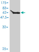 Western blot against tagged recombinant protein immunogen using ab56376 MAP1 antibody at 1ug/ml.