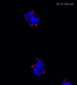 ab62116 staining MAP1LC3A in Mouse spenocytes by ICC/IF (Immunocytochemistry/immunofluorescence). Cells were fixed with paraformaldehyde, permeabilized with Triton X-100 0.1% in PBS and blocked with 2% serum for 60 minutes at 25°C. Samples were incubated with primary antibody (1 ug/ml in 2% FBS in PBS) for 24 hours at 4°C.See Abreview