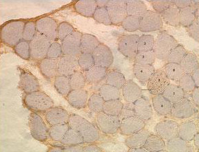 Immunohistochemistry analysis of muscle tissue of a diseased Mouse off Dox after 5 weeks on regular food CD2 labeling MAP1LC3A with ab168803 at 1/50.