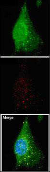 Immunocytochemistry analysis of Mouse cerebellar cell lines stably expressing Human GFP-MAP1LC3A fusion protein labeling MAP1LC3A with ab168803 at 1/10. Conditions: 1:1 methanol:acetone fixation, 0.2% saponin permeabilization.