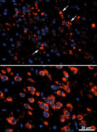 Immunocytochemistry analysis of Cathepsin D WT (bottom) and KO (top) Mouse thalamus (postnatal day 25) labeling MAP1LC3A with ab168803 at 1/10.