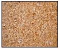 ab52628, at a 1/50 dilution, staining Human MAPILC3A in brain using Immunohistochemistry, Paraffin Embedded Tissue.