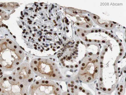 Image courtesy of Human Protein Atlasab25388 staining HEXIM1 in human kidney. Paraffin embedded human kidney tissue was incubated with ab25388 (1/100 dilution) for 30 mins at room temperature. Antigen retrieval was performed by heat induction in citrate buffer pH 6. ab25388 was tested in a tissue microarray (TMA) containing a wide range of normal and cancer tissues as well as a cell microarray consisting of a range of commonly used, well characterised human cell lines. Further results for this antibody can be found at www.proteinatlas.org