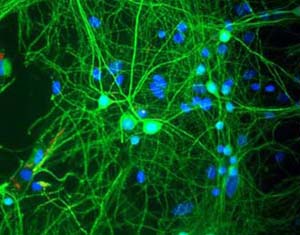 ab5392 at a dilution of 1/10000, staining MAP 2 (green) in tissue cultured rat cortical neurons by immunofluorescence. Nuclei are stained blue with Dapi.