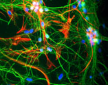 Rat cortical neurons and glia in mixed tissue culture stained with ab5392 (Chicken antibody to MAP2) (green)(1:30 000), a mouse monoclonal antibody to GFAP (red) and nuclei of all cells stained with Hoechst dye (blue).
