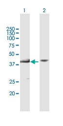 All lanes : Anti-MAP3K12 binding inhibitory protein 1 antibody (ab169447) at 1 µg/mlLane 1 : MAP3K12 transfected lysateLane 2 : Non-transfected lysateLysates/proteins at 15 µl per lane.