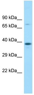 Anti-MAP3K12 binding inhibitory protein 1 antibody (ab133909) at 1 µg/ml + Human fetal bladder lysate at 10 µg