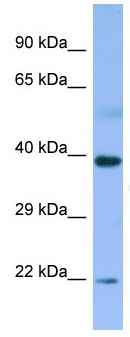 Anti-MAP3K12 binding inhibitory protein 1 antibody (ab133938) at 1 µg/ml + Human fetal small intestine lysate at 10 µg