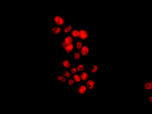 Immunofluorescent staining of HepG2 cells labeling MAP3K12 binding inhibitory protein 1 with ab181040 at 1/100 dilution.