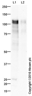 All lanes : Anti-MAP4 antibody (ab89650) at 1 µg/mlLane 1 : Testis (Human) Tissue Lysate - adult normal tissue (ab30257)Lane 2 : Spinal Cord (Human) Tissue Lysate - adult normal tissue (ab29188)Lysates/proteins at 10 µg per lane.SecondaryGoat polyclonal to Rabbit IgG - H&L - Pre-Adsorbed (HRP) at 1/3000 dilutiondeveloped using the ECL techniquePerformed under reducing conditions.