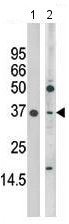 All lanes : Anti-MAPK11 antibody - Aminoterminal end (ab71518) at 1/100 dilutionLane 1 : Mouse heart lysateLane 2 : Mouse brain lysateLysates/proteins at 12.5 µg per lane.